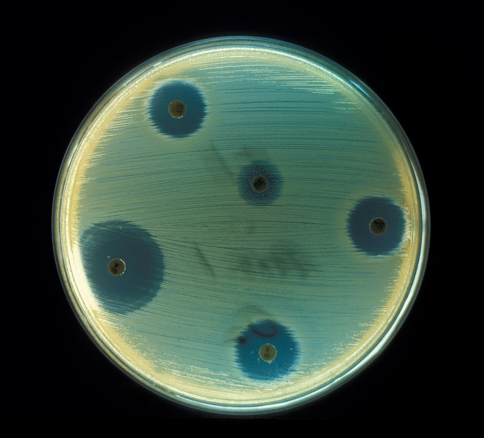 Плесень в чашке с колонией бактерий. Прозрачные круги вокруг грибка — области, где бактерии погибли Don Stalons (phil.cdc.gov)/Wikimedia Commons
