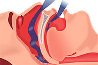 Проблемы с дыханием во время сна грозят появлением болей в суставах