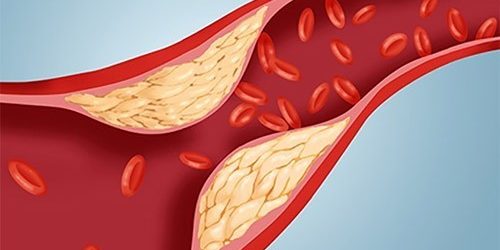 Ученые утверждают, что «плохой холестерин» — просто раздутый миф — МедНовости