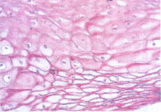 Рис. 5.8. Фрагмент слизистой оболочки пищевода, видны баллонные клетки. Очевидно наличие глыбок гликогена в клетках. Окраска Pas, x500