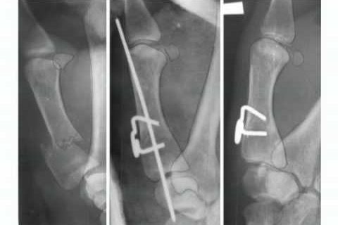 Повреждение кисти   damage to the brush