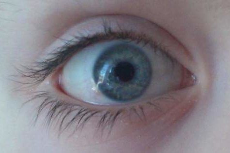 Создан имплант, предотвращающий возрастную слепоту