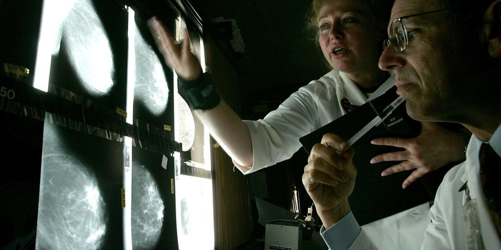 Times: риск развития рака груди у женщин-«жаворонков» на 40% ниже, чем у «сов» — Общество