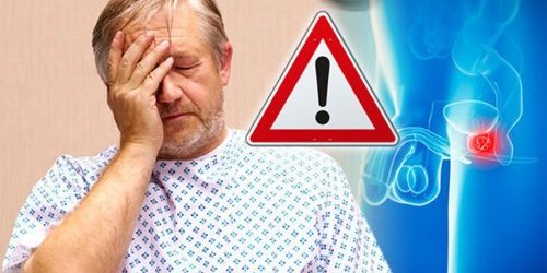 При раке простаты мужчины готовы жертвовать вероятностью выживания ради качества жизни — МедНовости