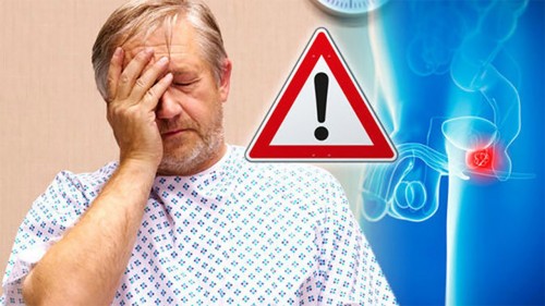 При раке простаты мужчины готовы жертвовать вероятностью выживания ради качества жизни — МедНовости