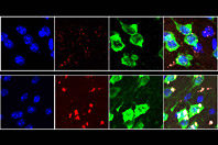 Генетики рассказали о реальной причине проблем с клетками мозга