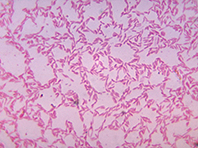 Неожиданное открытие: в головном мозге обитают кишечные бактерии