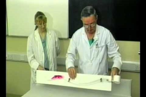 Патофизиология спинальной анестезии