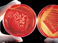 Россия всерьез займется проблемой резистентных бактерий