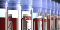 В Африке испытывают принципиально новый препарат для лечения ВИЧ-инфекции