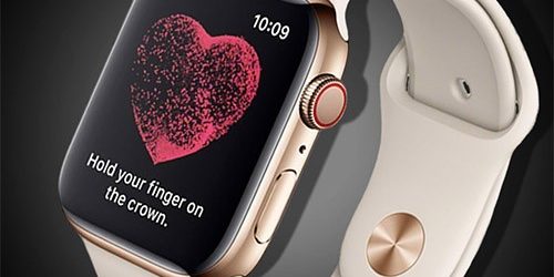 Часы Apple Watch поставили мужчине диагноз опасной аритмии сразу после включения — МедНовости