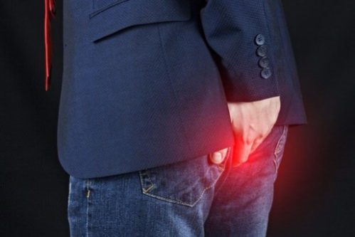 Геморрой у женщин и мужчин — МедНовости