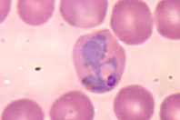 Австралийские ученые выяснили, как малярийному паразиту удается проникать в клетки человека