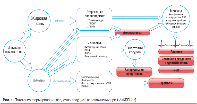 Рис. 1. Патогенез формирования сердечно-сосудистых осложнений при НАЖБП [37]