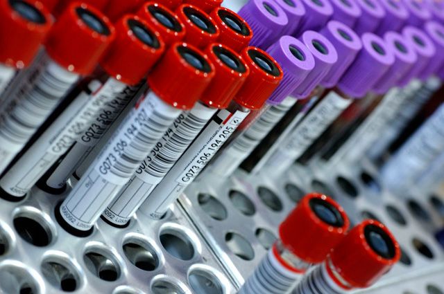 Самые неожиданные факторы риска сепсиса