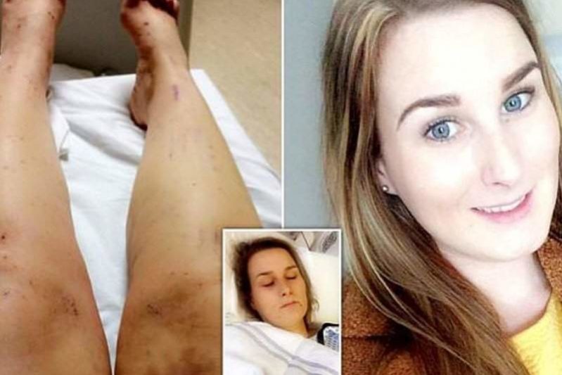 Оральный контрацептив едва не убил печень девушки