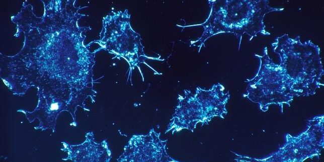 Найдено вещество, предотвращающее метастазы — Медицина 2.0