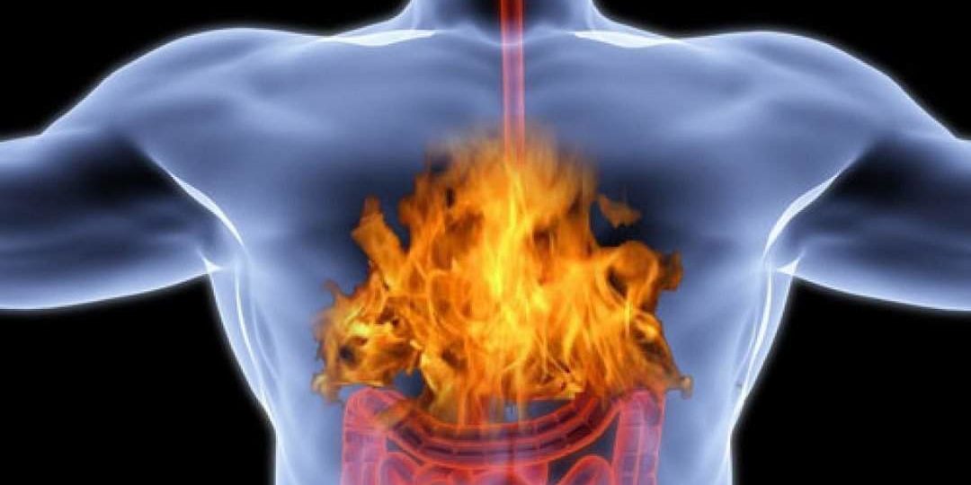 Четыре продукта, которые спасут от изжоги