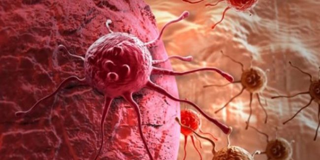 Ученые «выключили» ген, отвечающий за распространение рака простаты