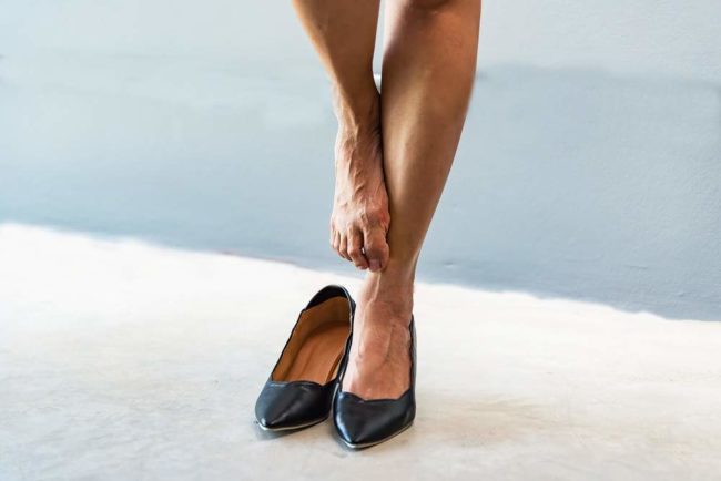 Флебологи назвали основные симптомы варикоза