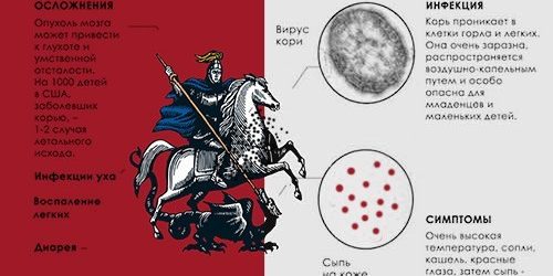 Корь снова в Москве — МедНовости