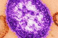 Эпидемия кори угрожает России, предупреждают медики