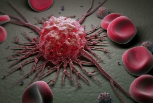Организм способен «съедать» раковые клетки