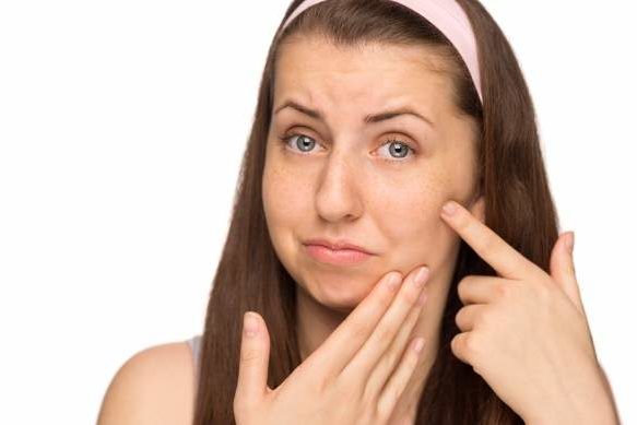 Названа еда, провоцирующая появление прыщей