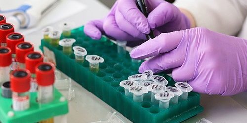 Папилломавирус, Helicobacter и кошачья двуустка: инфекции, причастные к развитию рака — МедНовости