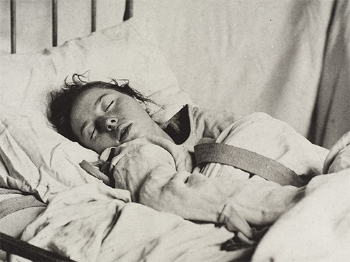 Психические расстройства увеличивают риск хронических заболеваний — МедНовости