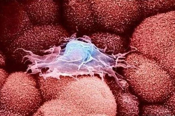 Названы привычки, которые помогут предотвратить рак