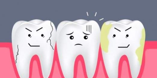 Стоматологи объяснили, как связаны кариес и рак