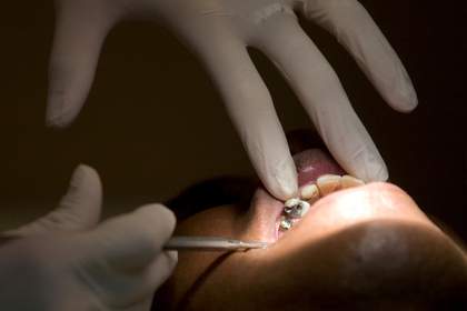 Названа смертельная опасность проблем с зубами