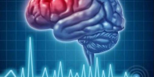 Медики назвали симптомы приближающегося инсульта