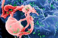 Американские вирусологи, кажется, нашли новый способ борьбы с ВИЧ