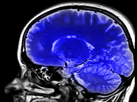 Используя робота и экстремальный холод, неврологи смогут победить рак мозга