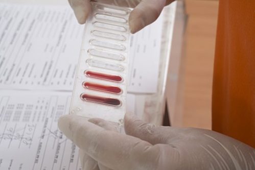 Эти продукты помогут побороть бессонницу