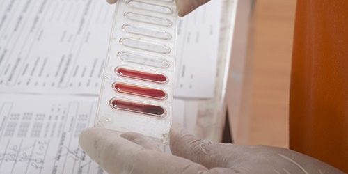 Эти продукты помогут побороть бессонницу