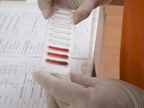 Эти продукты помогут побороть бессонницу