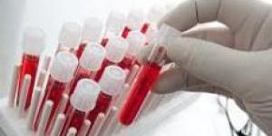 Эти продукты помогают справиться с усталостью