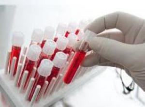 Эти продукты помогают справиться с усталостью