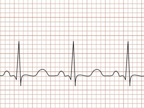 Частоту пульса связали с риском смерти и болезней сердца — МедНовости
