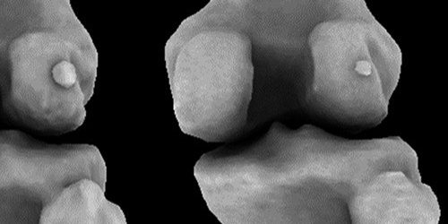 Кость, исчезнувшая века назад, вернулась и вызывает у нас боль — МедНовости