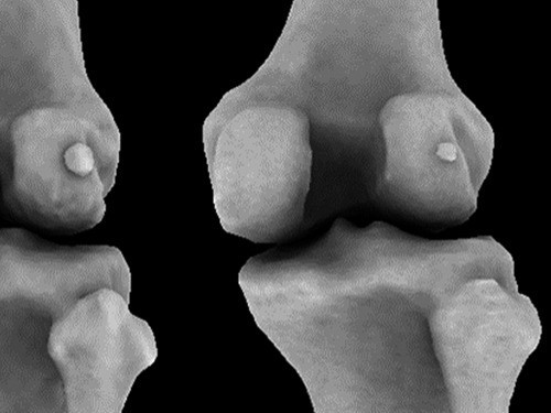 Кость, исчезнувшая века назад, вернулась и вызывает у нас боль — МедНовости