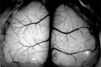 Неврологи увидели, что происходит в мозге с помощью «прозрачного черепа»