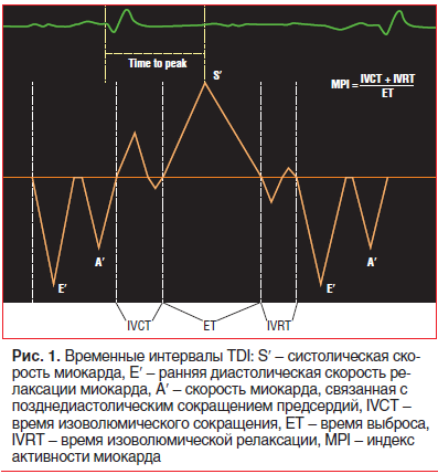 Рис. 1. Временные интервалы TDI: Sʹ – систолическая ско- рость миокарда, Eʹ – ранняя диастолическая скорость релаксации миокарда, Aʹ – скорость миокарда, связанная с позднедиастолическим сокращением предсердий, IVCT – время изоволюмического сокращения, ET