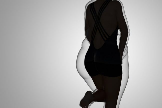 Роспотребнадзор: в России растет число пациентов ожирением