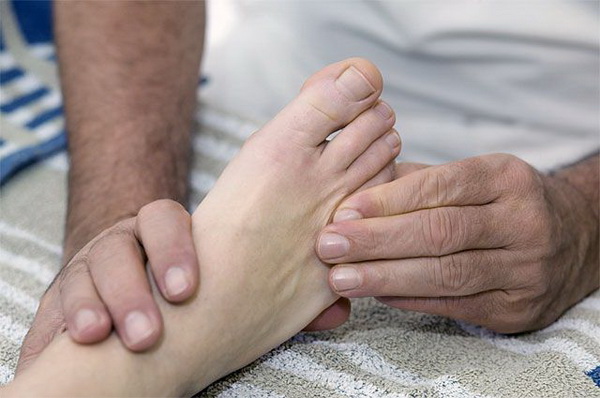 Изменения в состоянии ног могут возникать как симптом повышенного холестерина