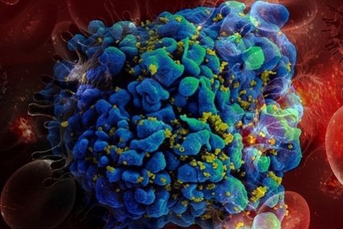 Пять важных вопросов о тестировании на ВИЧ — МедНовости