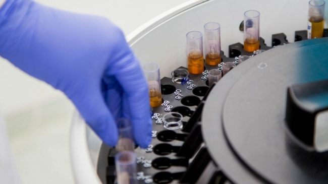 Названы причины хронической болезни почек